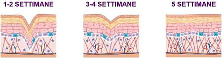 Miglioramente dell'epidermide settimanale durante il trattamento Beauty Routine